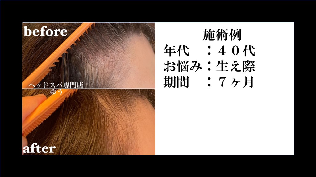 Before & After 3