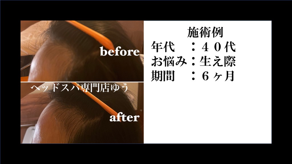 Before & After 6