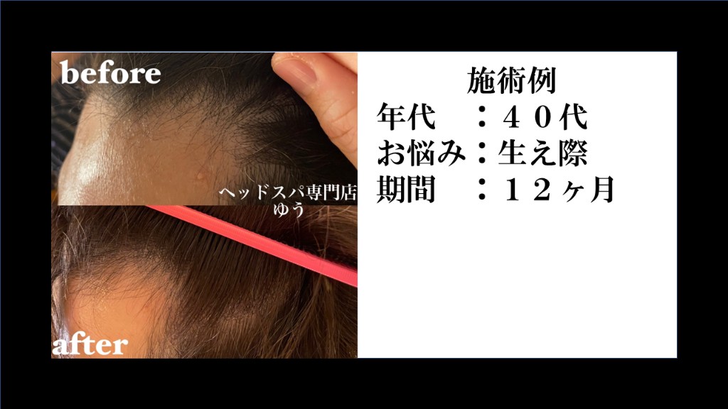 Before & After 8