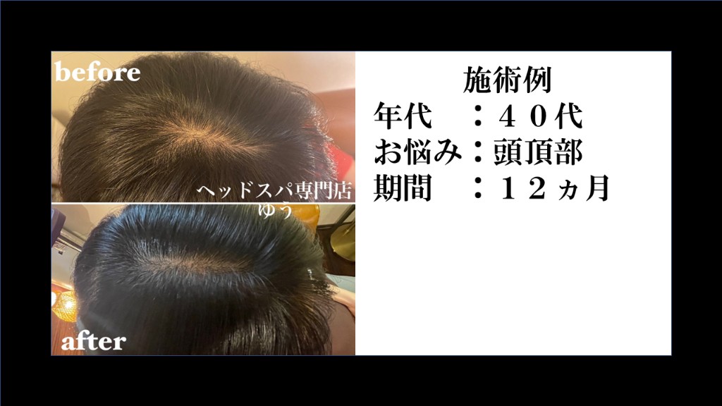 Before & After 19