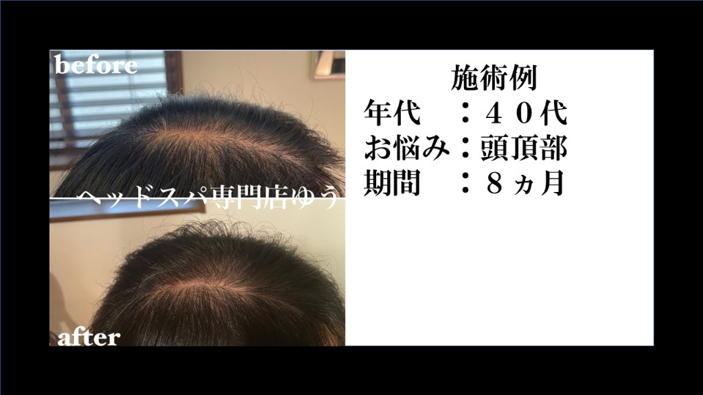 Before & After 22